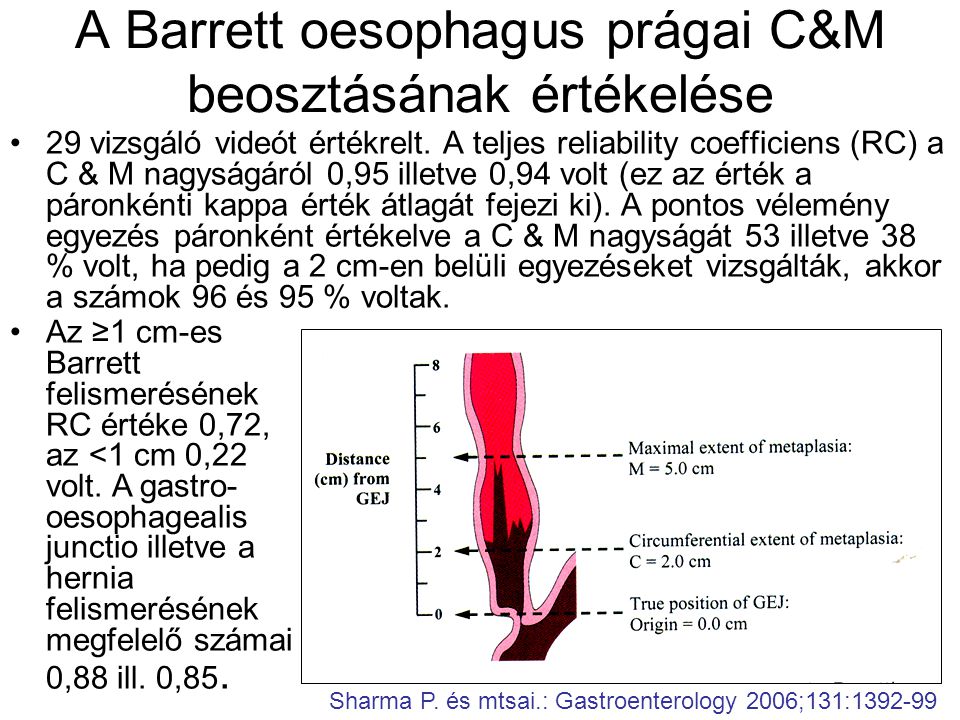 A Barrett oesophagus prágai C&M beosztásának értékelése •29 vizsgáló videót értékrelt.