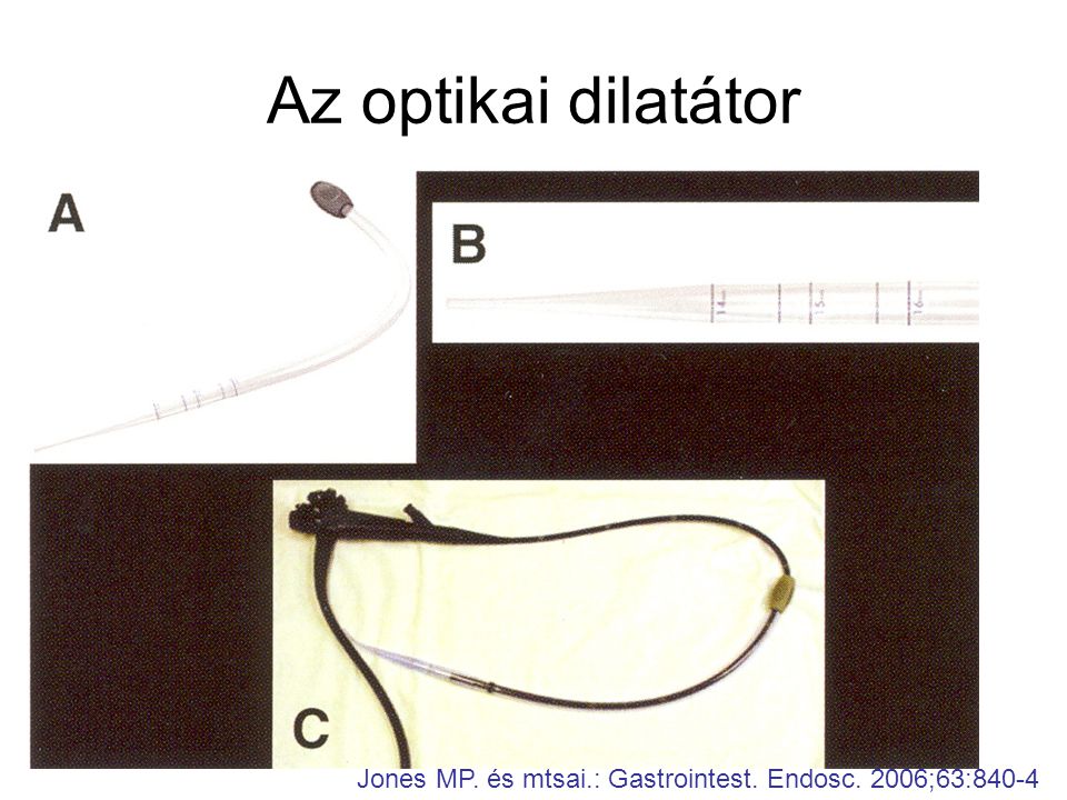 Az optikai dilatátor Jones MP. és mtsai.: Gastrointest. Endosc. 2006;63:840-4