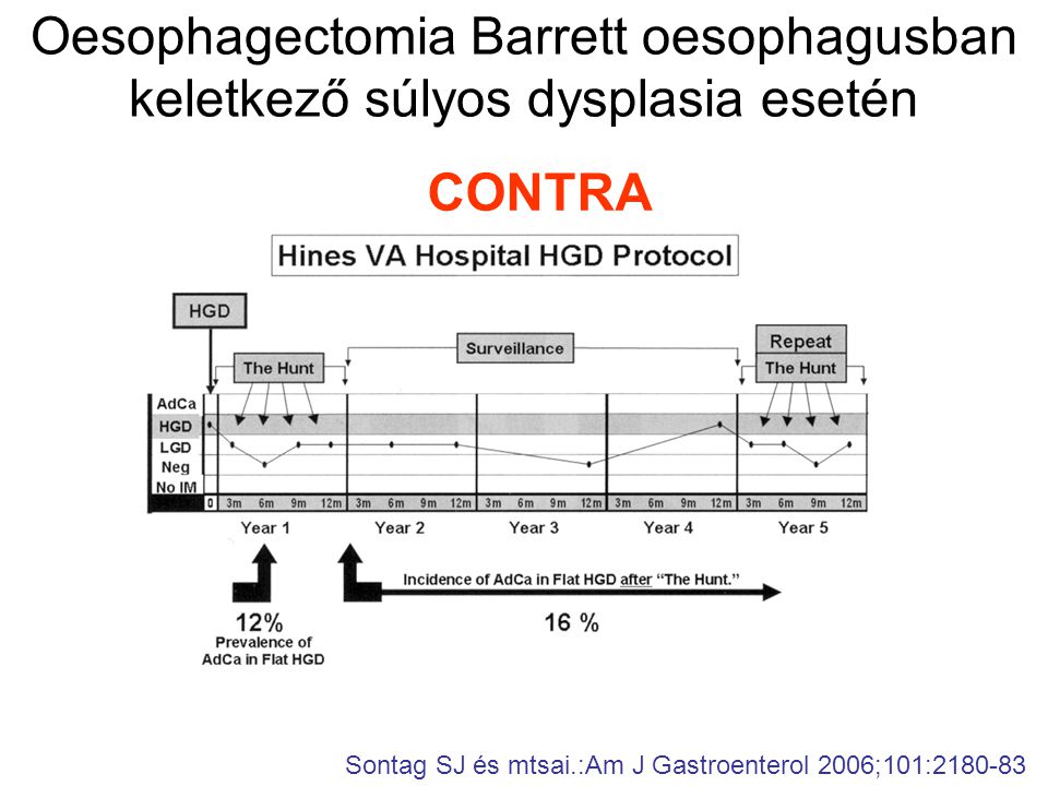 Oesophagectomia Barrett oesophagusban keletkező súlyos dysplasia esetén CONTRA Sontag SJ és mtsai.:Am J Gastroenterol 2006;101: