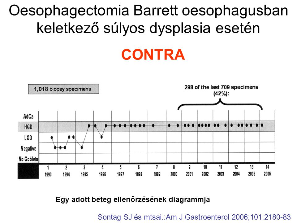 Oesophagectomia Barrett oesophagusban keletkező súlyos dysplasia esetén CONTRA Sontag SJ és mtsai.:Am J Gastroenterol 2006;101: Egy adott beteg ellenőrzésének diagrammja