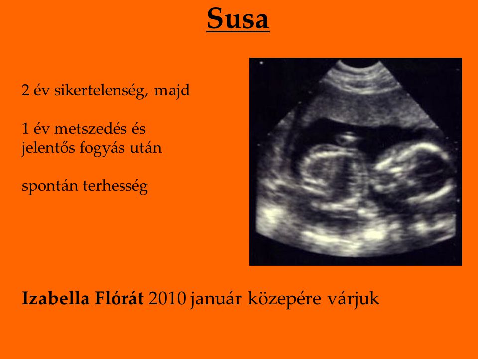 Susa 2 év sikertelenség, majd 1 év metszedés és jelentős fogyás után spontán terhesség Izabella Flórát 2010 január közepére várjuk