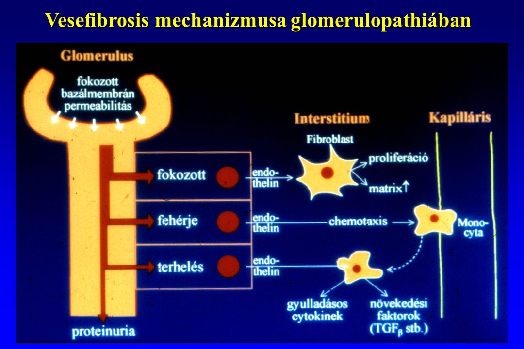 Vesefibrosis mechanizmusa glomerulopathiában