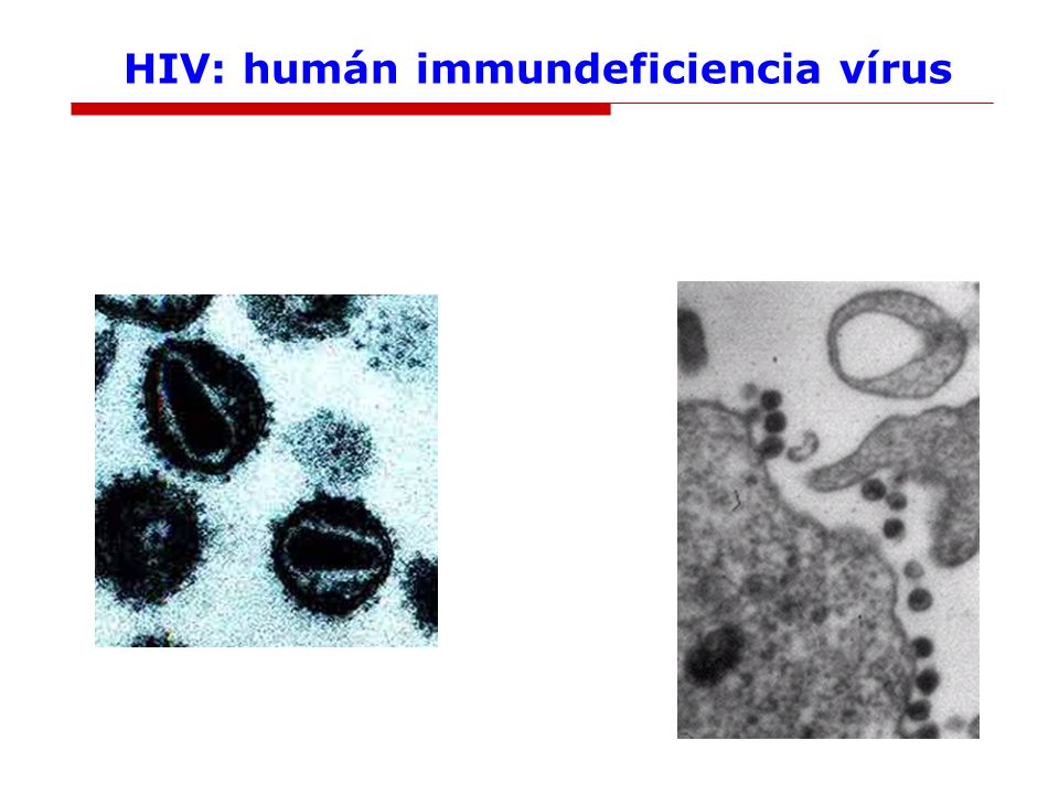 HIV: humán immundeficiencia vírus