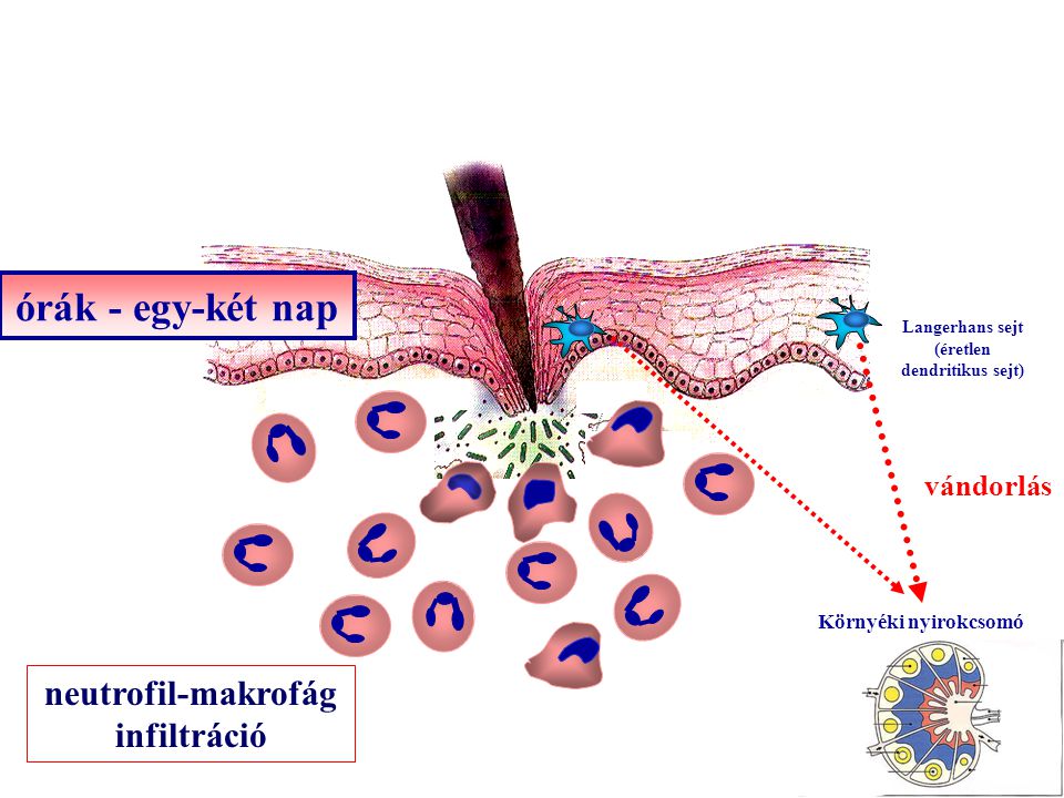 órák - egy-két nap Langerhans sejt (éretlen dendritikus sejt) Környéki nyirokcsomó neutrofil-makrofág infiltráció vándorlás