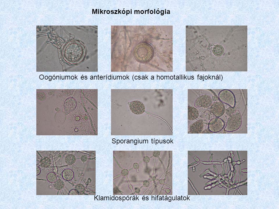 Mikroszkópi morfológia Oogóniumok és anterídiumok (csak a homotallikus fajoknál) Sporangium típusok Klamidospórák és hifatágulatok