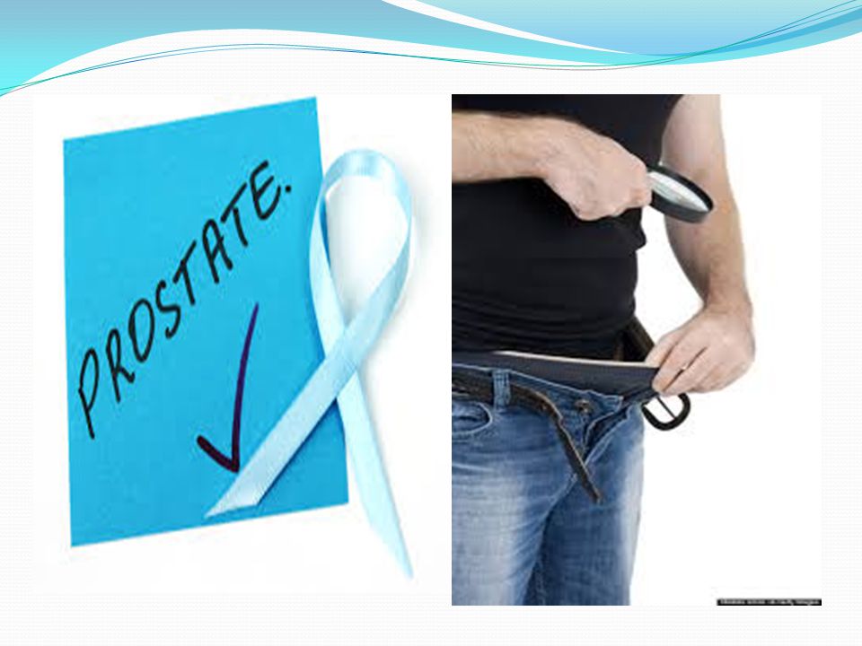 Prosztata előadás Prostatitis és kezelésszimulátorok