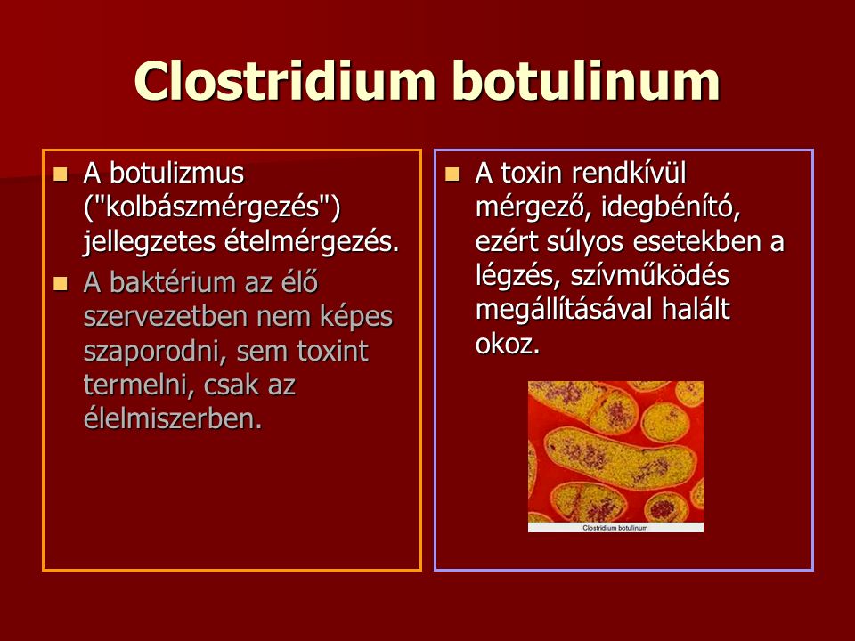 Clostridium botulinum A botulizmus ( kolbászmérgezés ) jellegzetes ételmérgezés.