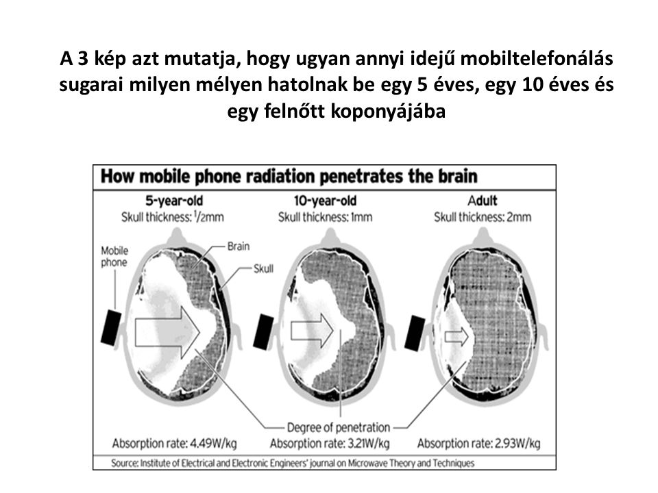 A 3 kép azt mutatja, hogy ugyan annyi idejű mobiltelefonálás sugarai milyen mélyen hatolnak be egy 5 éves, egy 10 éves és egy felnőtt koponyájába