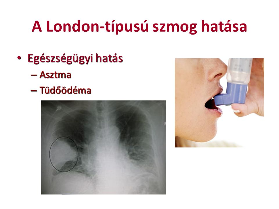 A London-típusú szmog hatása Egészségügyi hatás Egészségügyi hatás – Asztma – Tüdőödéma