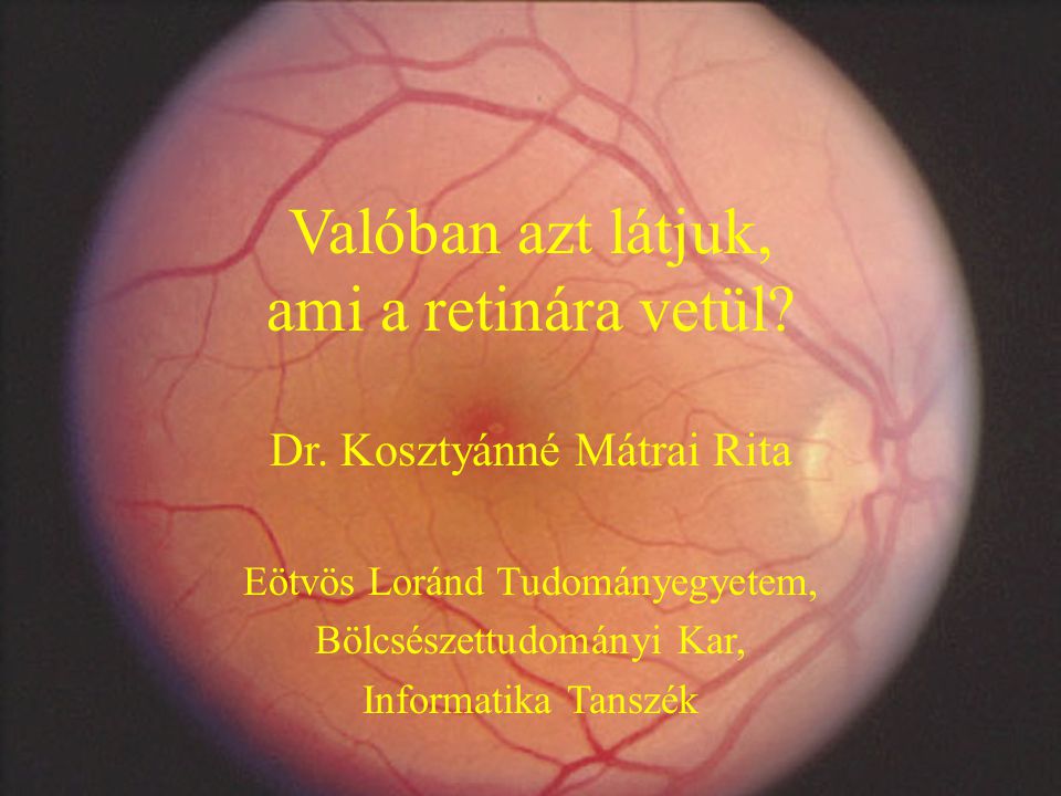 Valóban azt látjuk, ami a retinára vetül. Dr.