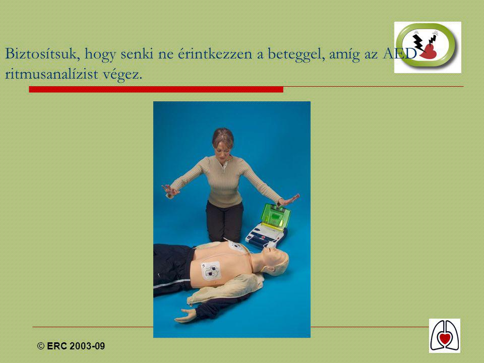 © ERC Biztosítsuk, hogy senki ne érintkezzen a beteggel, amíg az AED ritmusanalízist végez.