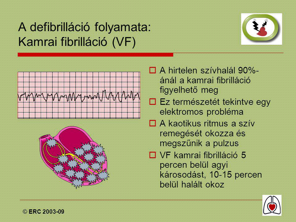 © ERC A defibrilláció folyamata: Kamrai fibrilláció (VF)  A hirtelen szívhalál 90%- ánál a kamrai fibrilláció figyelhető meg  Ez természetét tekintve egy elektromos probléma  A kaotikus ritmus a szív remegését okozza és megszűnik a pulzus  VF kamrai fibrilláció 5 percen belül agyi károsodást, percen belül halált okoz
