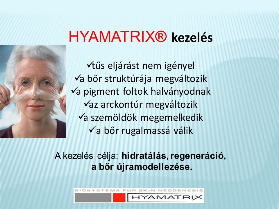 HYAMATRIX® kezelés  tűs eljárást nem igényel  a bőr struktúrája megváltozik  a pigment foltok halványodnak  az arckontúr megváltozik  a szemöldök megemelkedik  a bőr rugalmassá válik A kezelés célja: hidratálás, regeneráció, a bőr újramodellezése.