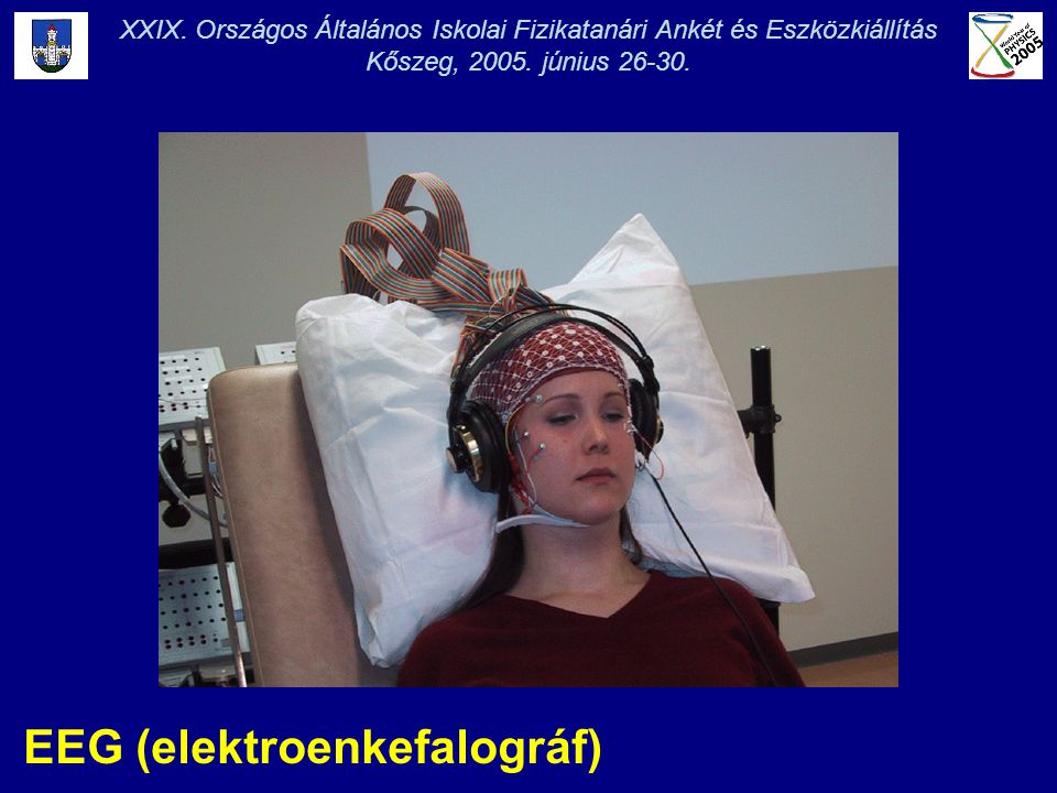 EEG (elektroenkefalográf) XXIX.