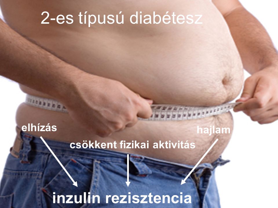 2-es típusú diabétesz csökkent fizikai aktivitás inzulin rezisztencia elhízás hajlam