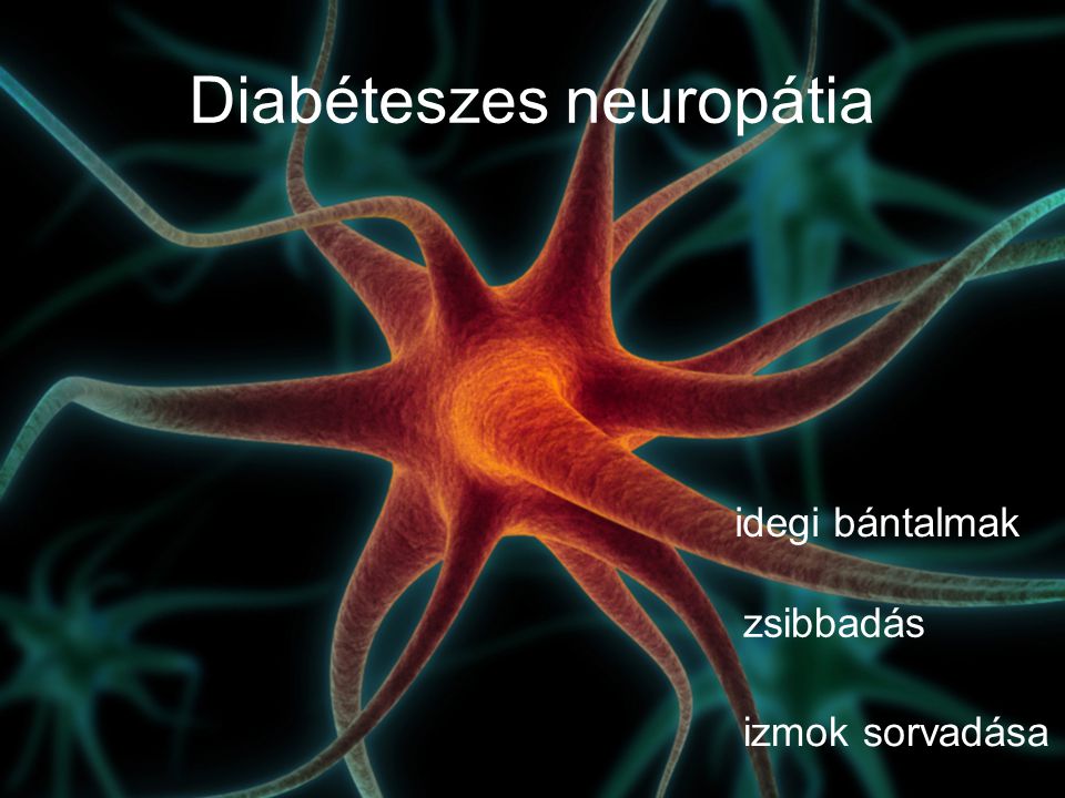 Diabéteszes neuropátia idegi bántalmak zsibbadás izmok sorvadása
