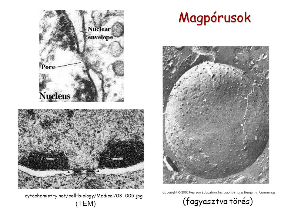 cytochemistry.net/cell-biology/Medical/03_005.jpg (TEM) Magpórusok (fagyasztva törés)