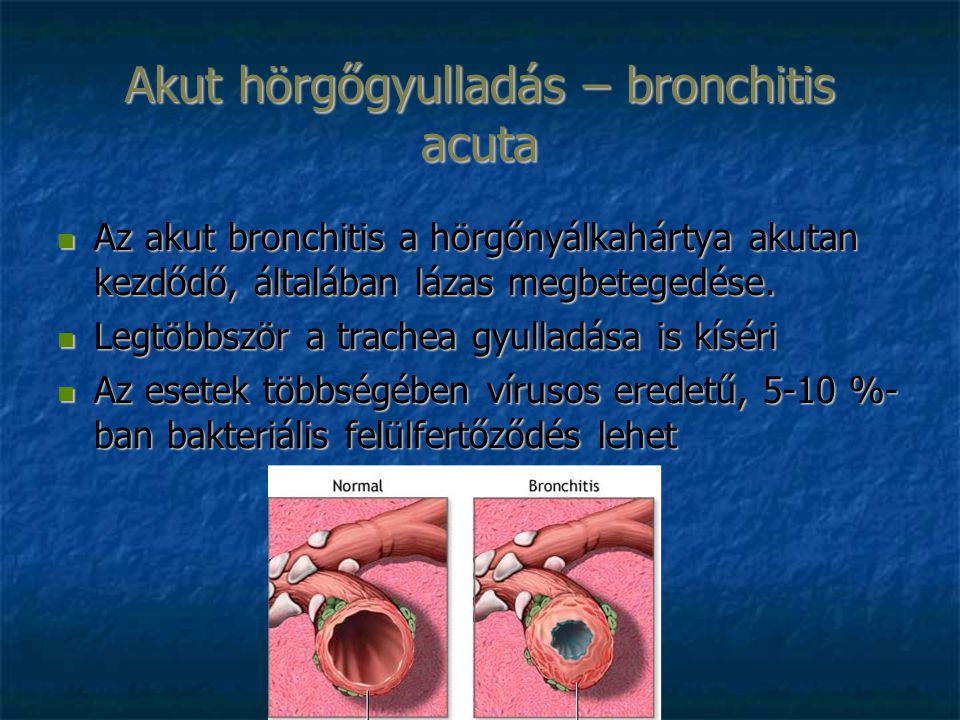 Bronchitis acuta jelentése