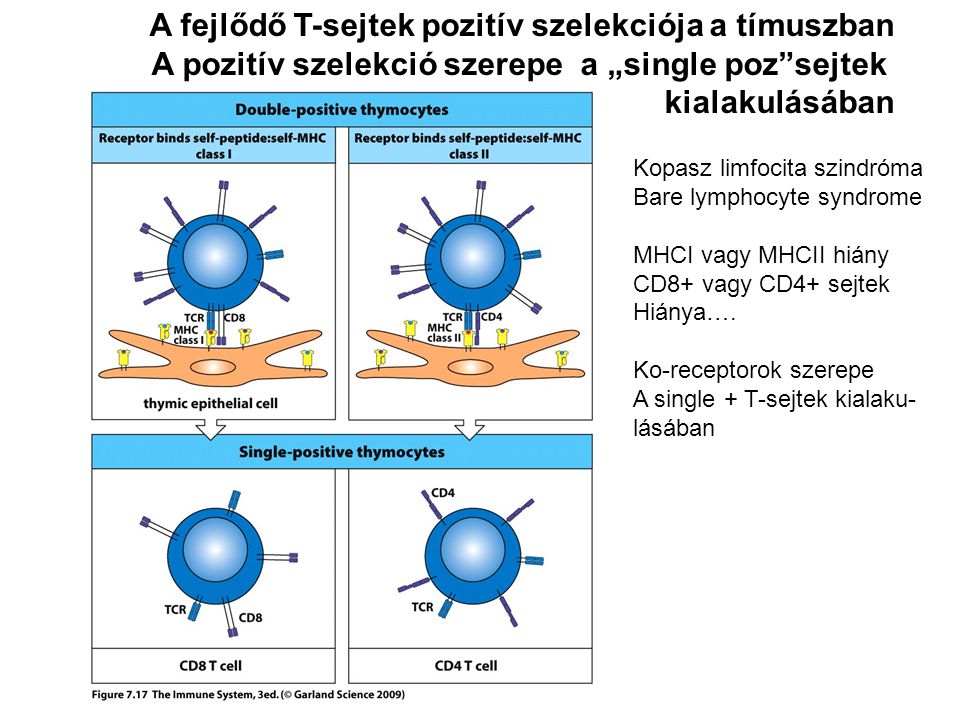 A pozitív szelekció szerepe a „single poz sejtek kialakulásában Kopasz limfocita szindróma Bare lymphocyte syndrome MHCI vagy MHCII hiány CD8+ vagy CD4+ sejtek Hiánya….
