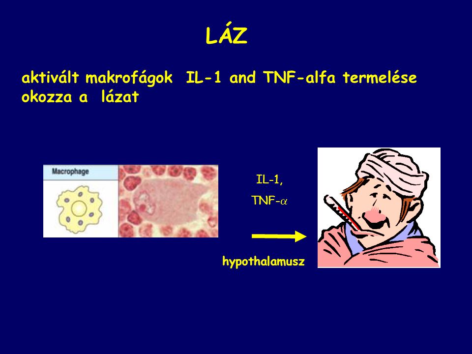IL-1, TNF-  LÁZ aktivált makrofágok IL-1 and TNF-alfa termelése okozza a lázat hypothalamusz
