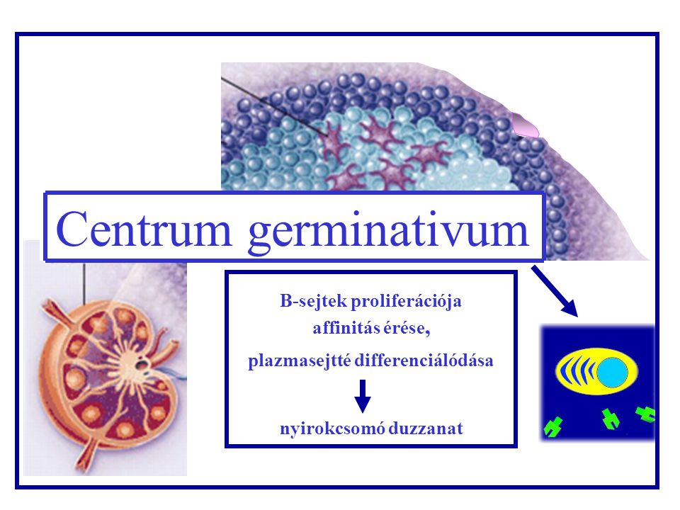 B sejtek proliferá- ciója Nyirokcso mó Centrum germinativum B-sejtek proliferációja affinitás érése, plazmasejtté differenciálódása nyirokcsomó duzzanat