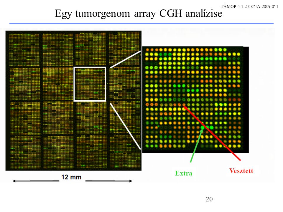 20 Egy tumorgenom array CGH analízise Extra Vesztett TÁMOP /1/A