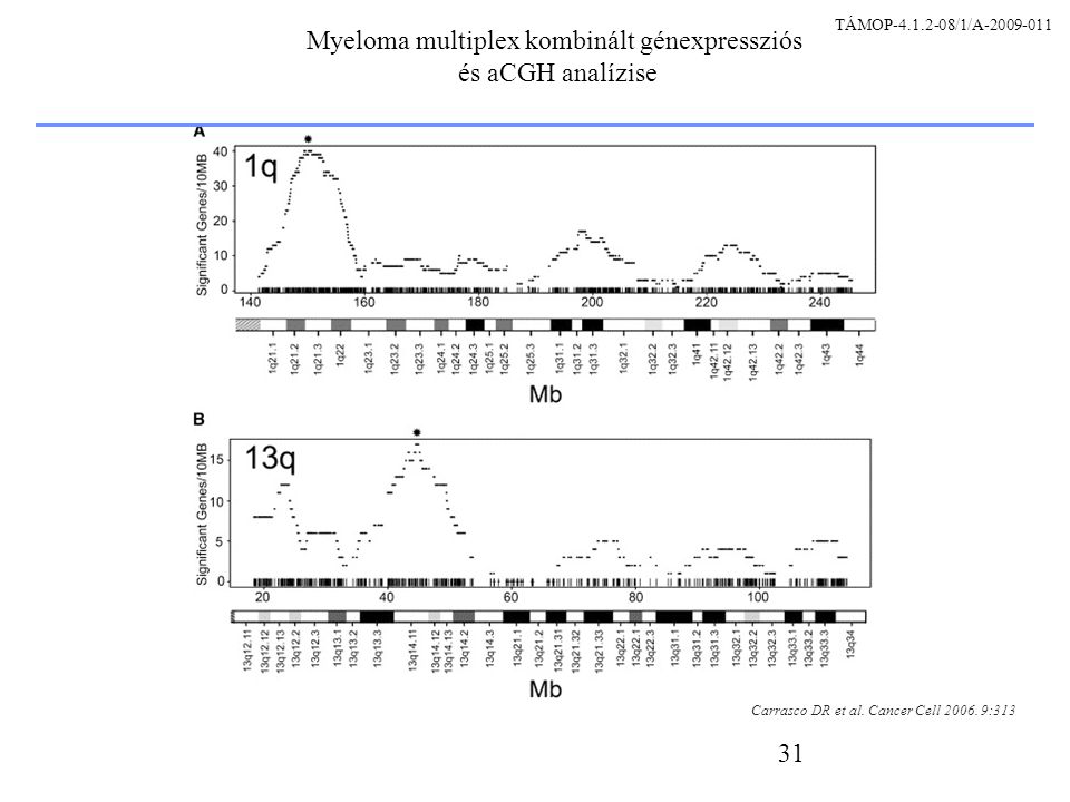 31 Myeloma multiplex kombinált génexpressziós és aCGH analízise Carrasco DR et al.