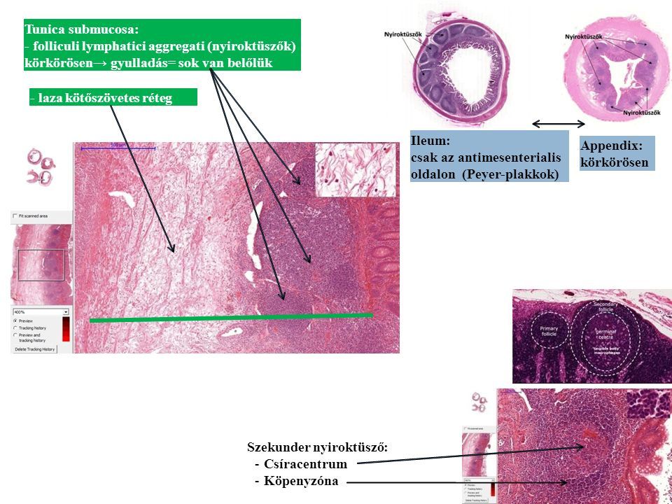 Tunica submucosa: - folliculi lymphatici aggregati (nyiroktüszők) körkörösen→ gyulladás= sok van belőlük - laza kötőszövetes réteg Szekunder nyiroktüsző: -Csíracentrum -Köpenyzóna Ileum: csak az antimesenterialis oldalon (Peyer-plakkok) Appendix: körkörösen